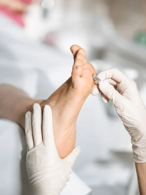 Ewelina Kałdowska, podolog, przy pracy. Usuwanie zrogowaceń